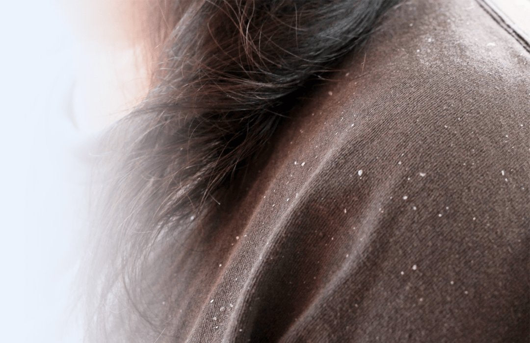 Buy Dandruff Treatment