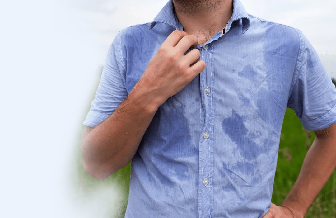 Excessive Sweating Treatment