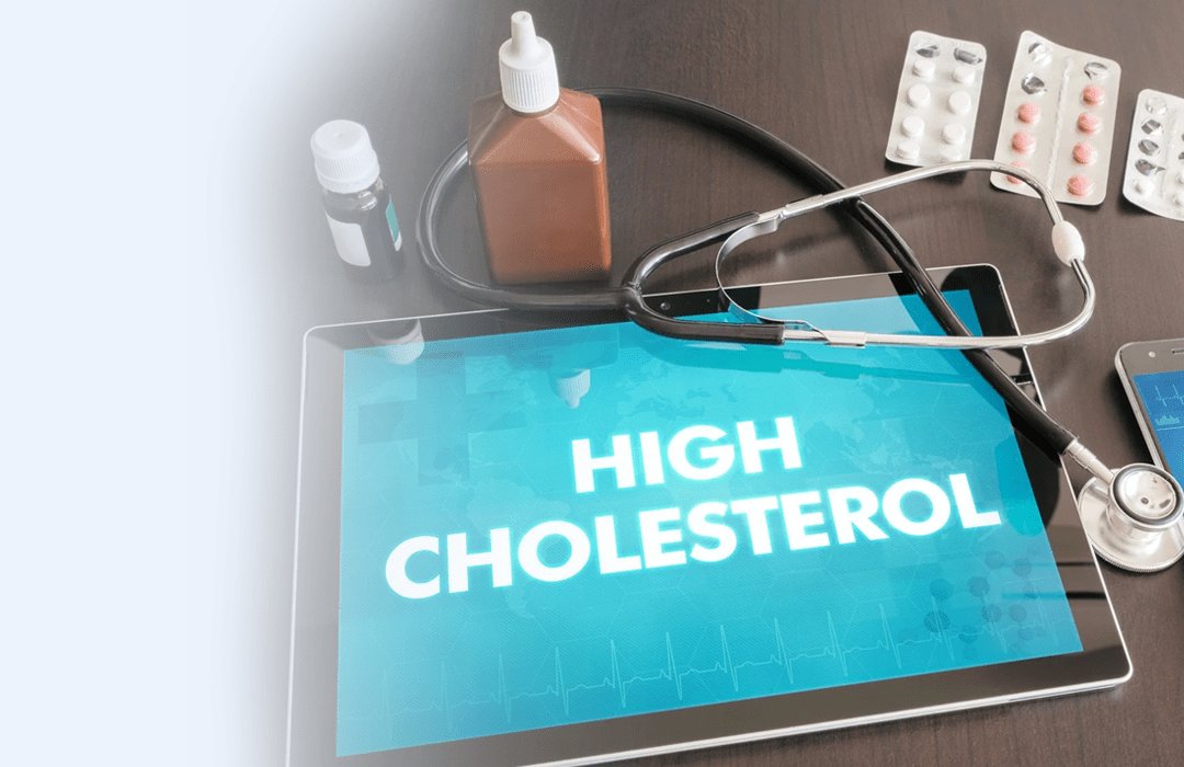 Buy High Cholesterol Treatment