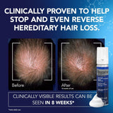 Regaine For Men Extra Strength - 3 Months' Supply